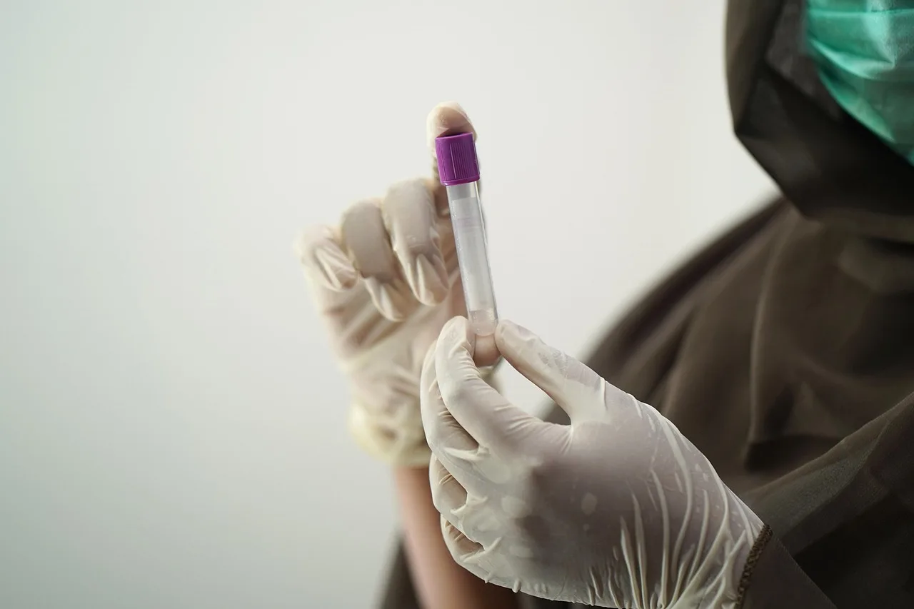 blood test, blood sample, medical technology, medical technologist, surgical gloves, face mask, sample, hospital worker, laboratory, lab, blood test, blood test, blood test, blood test, blood test, sample, laboratory, laboratory, laboratory, lab, lab. Can Healthcare SEO Improve Without Breaking What Already Ranks?